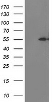 HEK293T cells were transfected with the pCMV6-ENTRY control (Left lane) or pCMV6-ENTRY ITFG2 (Right lane) cDNA for 48 hrs and lysed. Equivalent amounts of cell lysates (5 ug per lane) were separated by SDS-PAGE and immunoblotted with anti-ITFG2.