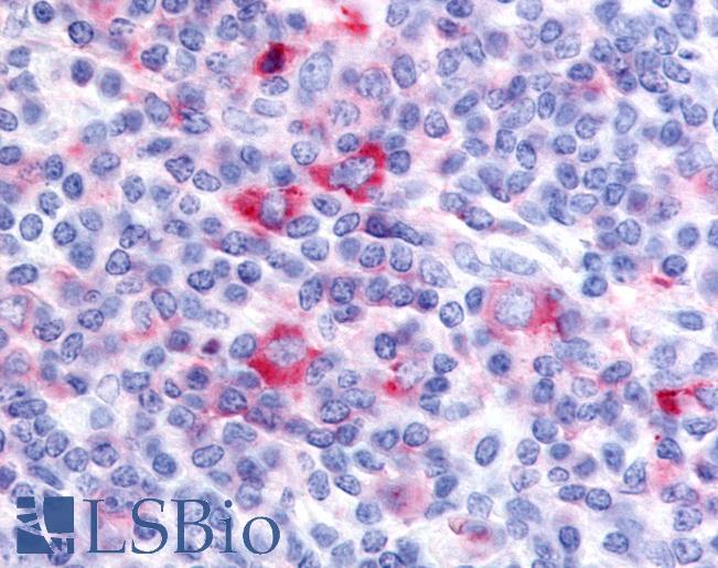 Anti-GPRC5D antibody LS-A4180 IHC of human tonsil. Immunohistochemistry of formalin-fixed, paraffin-embedded tissue after heat-induced antigen retrieval.