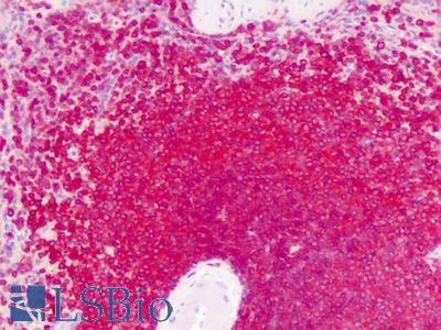 Anti-GPRC6A antibody IHC of human spleen, lymphocytes. Immunohistochemistry of formalin-fixed, paraffin-embedded tissue after heat-induced antigen retrieval. Antibody LS-A2575 dilution 10-20 ug/ml.