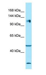 ITGA2 / CD49b antibody Western Blot of HT1080.