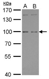 GPRC6A antibody [C3], C-term detects GPRC6A protein by Western blot analysis. A. 30 ug Raji whole cell lysate/extract. B. 30 ug K562 whole cell lysate/extract. 7.5 % SDS-PAGE. GPRC6A antibody [C3], C-term dilution:1:500