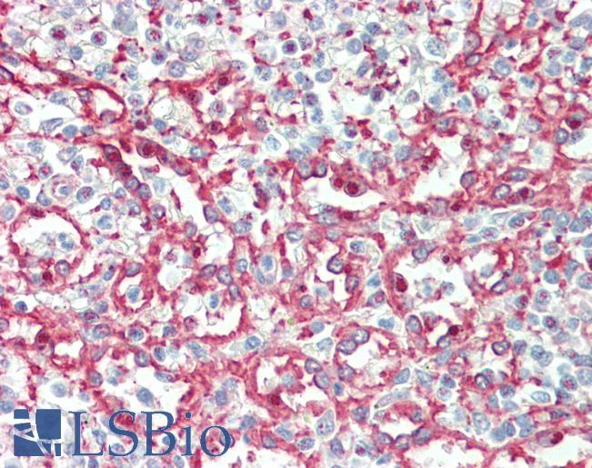 Anti-ITGA2B / CD41 antibody IHC staining of human spleen. Immunohistochemistry of formalin-fixed, paraffin-embedded tissue after heat-induced antigen retrieval. Antibody LS-B9763 concentration 5 ug/ml.