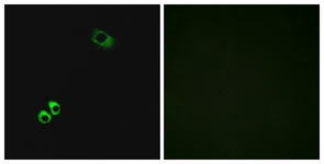 Immunofluorescence of MCF7 cells, using GPRC6A Antibody. The picture on the right is treated with the synthesized peptide.