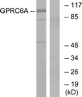 Western blot of extracts from Jurkat cells, using GPRC6A Antibody. The lane on the right is treated with the synthesized peptide.