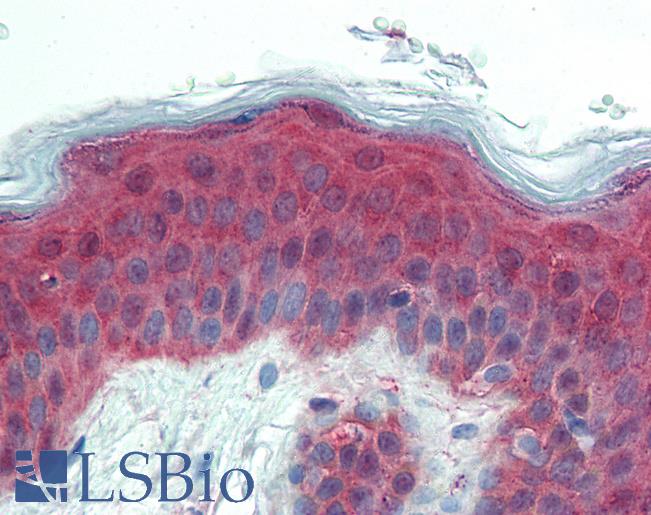 Anti-ITGA3 / CD49c antibody LS-A8140 IHC of human skin. Immunohistochemistry of formalin-fixed, paraffin-embedded tissue after heat-induced antigen retrieval.