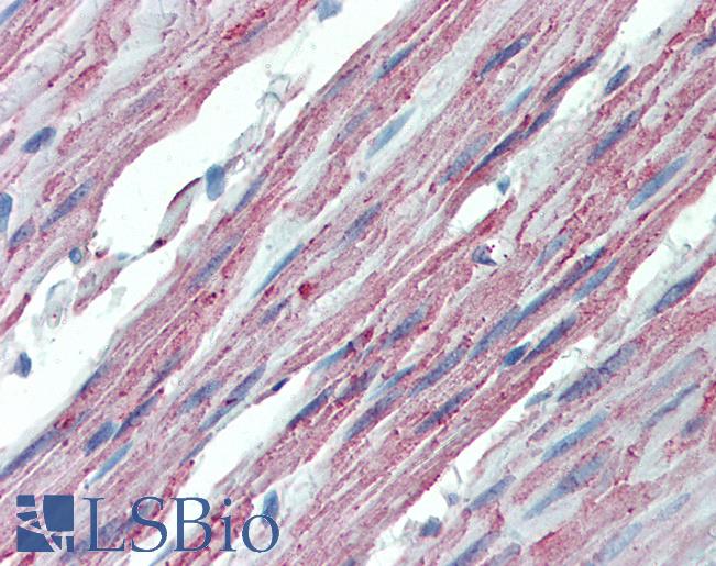 Anti-ITGA3 / CD49c antibody LS-A8140 IHC of human colon. Immunohistochemistry of formalin-fixed, paraffin-embedded tissue after heat-induced antigen retrieval.