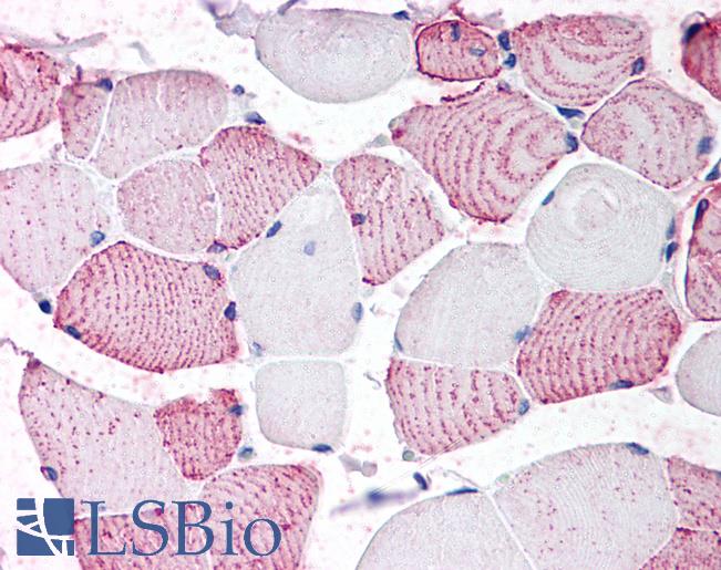 Anti-GPRC6A antibody LS-A2581 IHC of human skeletal muscle. Immunohistochemistry of formalin-fixed, paraffin-embedded tissue after heat-induced antigen retrieval.