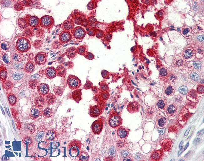 Anti-GPRC6A antibody IHC staining of human testis. Immunohistochemistry of formalin-fixed, paraffin-embedded tissue after heat-induced antigen retrieval.