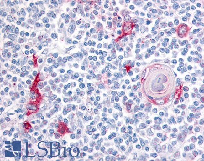 Anti-ITGA4 / Integrin Alpha 4 antibody LS-A9388 IHC of human thymus, medulla. Immunohistochemistry of formalin-fixed, paraffin-embedded tissue after heat-induced antigen retrieval.