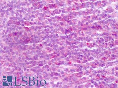 Anti-VLA-4 / CD49D antibody IHC of human tonsil. Immunohistochemistry of formalin-fixed, paraffin-embedded tissue after heat-induced antigen retrieval. Antibody LS-A9385 dilution 10-20 ug/ml.