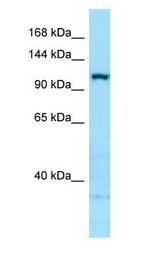 ITGA5/Integrin Alpha 5/CD49e antibody Western Blot of MDA-MB-435S.