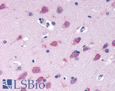 Anti-GPRC6A antibody LS-A2576 IHC of human brain, neurons and glia. Immunohistochemistry of formalin-fixed, paraffin-embedded tissue after heat-induced antigen retrieval.