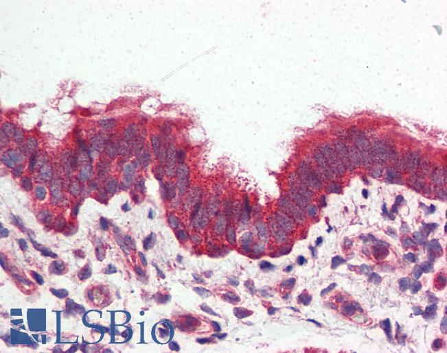 Anti-GPRC6A antibody LS-A2577 IHC of human lung, respiratory epithelium. Immunohistochemistry of formalin-fixed, paraffin-embedded tissue after heat-induced antigen retrieval.