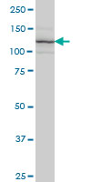 ITGA7 monoclonal antibody (M01), clone 8G2 Western Blot analysis of ITGA7 expression in Jurkat.