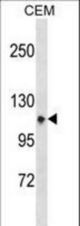 ITGA7 Antibody western blot of CEM cell line lysates (35 ug/lane). The ITGA7 antibody detected the ITGA7 protein (arrow).