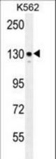 ITGA8 Antibody western blot of K562 cell line lysates (35 ug/lane). The ITGA8 antibody detected the ITGA8 protein (arrow).
