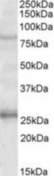 GPRIN3 antibody (1 ug/ml) staining of Human Hippocampus lysate (35 ug protein/ml in RIPA buffer). Primary incubation was 1 hour. Detected by chemiluminescence.
