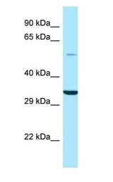 GPS1 / CSN1 antibody Western Blot of HT1080.