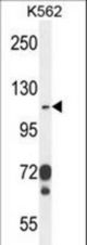 ITGAE Antibody western blot of K562 cell line lysates (35 ug/lane). The ITGAE antibody detected the ITGAE protein (arrow).