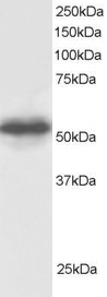 Antibody staining (0.5 ug/ml) of Human Testis lysate (RIPA buffer, 30 ug total protein per lane). Primary incubated for 1 hour. Detected by Western blot of chemiluminescence.