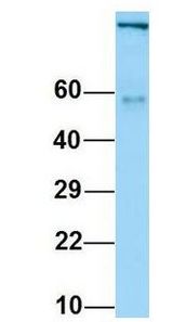 ITGAV/Integrin Alpha V/CD51 antibody Western Blot of Human Fetal Heart. Antibody Dilution: 1.0 ug/ml. Antibody dilution: 1 ug/ml.