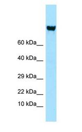 ITGAV/Integrin Alpha V/CD51 antibody Western Blot of PANC1.