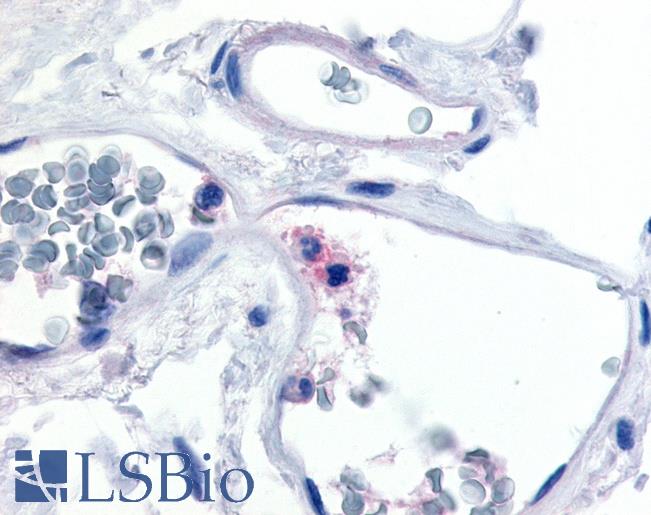 Anti-CD11c antibody LS-A9381 IHC of human colon, neutrophils. Immunohistochemistry of formalin-fixed, paraffin-embedded tissue after heat-induced antigen retrieval.