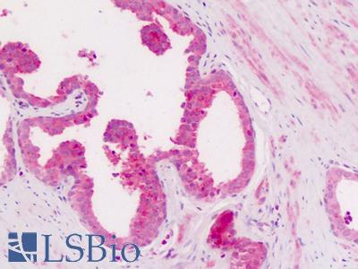 Anti-CD11c antibody IHC of human prostate. Immunohistochemistry of formalin-fixed, paraffin-embedded tissue after heat-induced antigen retrieval. Antibody LS-A9382 dilution 10-20 ug/ml.
