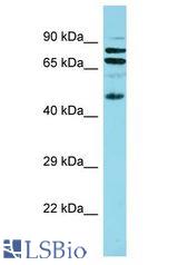 GPSM2 / LGN antibody Western Blot of Fetal Small Intestine. Antibody dilution: 1 ug/ml.
