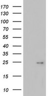HEK293T cells were transfected with the pCMV6-ENTRY control (Left lane) or pCMV6-ENTRY ITGB1BP1 (Right lane) cDNA for 48 hrs and lysed. Equivalent amounts of cell lysates (5 ug per lane) were separated by SDS-PAGE and immunoblotted with anti-ITGB1BP1.