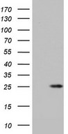 HEK293T cells were transfected with the pCMV6-ENTRY control (Left lane) or pCMV6-ENTRY ITGB1BP1 (Right lane) cDNA for 48 hrs and lysed. Equivalent amounts of cell lysates (5 ug per lane) were separated by SDS-PAGE and immunoblotted with anti-ITGB1BP1.