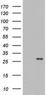 HEK293T cells were transfected with the pCMV6-ENTRY control (Left lane) or pCMV6-ENTRY ITGB1BP1 (Right lane) cDNA for 48 hrs and lysed. Equivalent amounts of cell lysates (5 ug per lane) were separated by SDS-PAGE and immunoblotted with anti-ITGB1BP1.