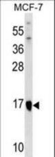 ITGB1BP1 Antibody western blot of MCF-7 cell line lysates (35 ug/lane). The ITGB1BP1 antibody detected the ITGB1BP1 protein (arrow).