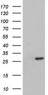 HEK293T cells were transfected with the pCMV6-ENTRY control (Left lane) or pCMV6-ENTRY ITGB1BP1 (Right lane) cDNA for 48 hrs and lysed. Equivalent amounts of cell lysates (5 ug per lane) were separated by SDS-PAGE and immunoblotted with anti-ITGB1BP1.