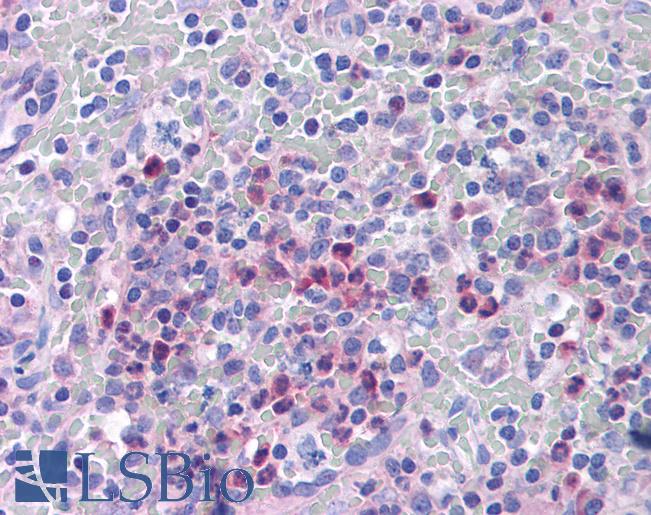 Anti-ITGB1BP1 antibody IHC of human spleen. Immunohistochemistry of formalin-fixed, paraffin-embedded tissue after heat-induced antigen retrieval. Antibody LS-B815 concentration 10 ug/ml.