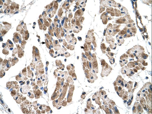 ITGB1BP2 antibody LS-C40382 was used in IHC to stain formalin-fixed, paraffin-embedded human muscle.
