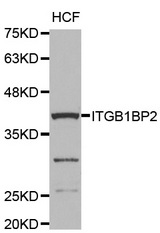 Western blot analysis of extracts of HCF cell line, using ITGB1BP2 antibody.