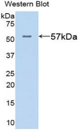 Western blot of recombinant GPT / Alanine Transaminase.