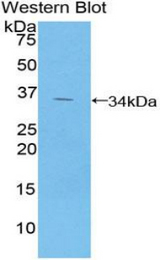 Western blot of recombinant GPT / Alanine Transaminase.