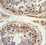 Formalin-fixed and paraffin-embedded human testis tissue reacted with ITGB3 Antibody , which was peroxidase-conjugated to the secondary antibody, followed by DAB staining. This data demonstrates the use of this antibody for immunohistochemistry; clinical relevance has not been evaluated.