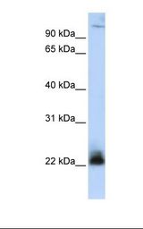 MCF7 cell lysate. Antibody concentration: 1.0 ug/ml. Gel concentration: 12%.