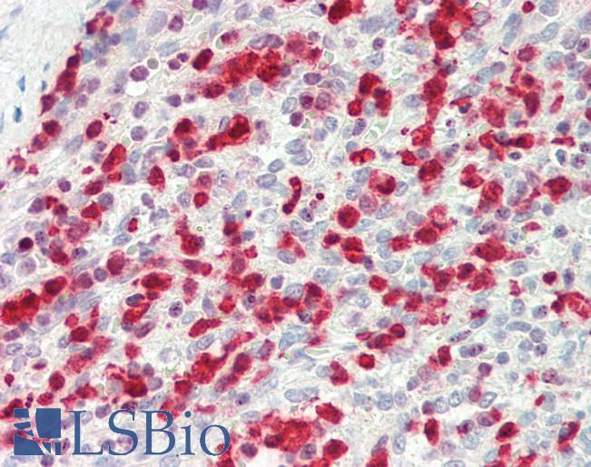Anti-ITGB5 / Integrin Beta 5 antibody IHC staining of human spleen. Immunohistochemistry of formalin-fixed, paraffin-embedded tissue after heat-induced antigen retrieval.