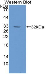 Western blot of recombinant ITIH2.