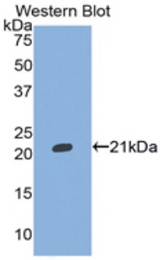 Western blot of recombinant ITIH5.