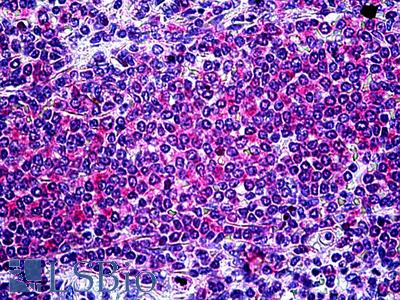 Anti-ITK antibody IHC of human spleen. Immunohistochemistry of formalin-fixed, paraffin-embedded tissue after heat-induced antigen retrieval. Antibody LS-B5130 concentration 3.75 ug/ml.