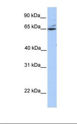 Fetal brain lysate. Antibody concentration: 1.0 ug/ml. Gel concentration: 12%.