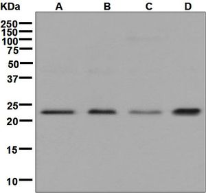 Western blot analysis on (A) Jurkat, (B) HepG2, (C) HeLa, and (D) K562 cell lysates using anti-ITPA antibody.