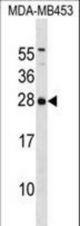 ITPA Antibody western blot of MDA-MB453 cell line lysates (35 ug/lane). The ITPA antibody detected the ITPA protein (arrow).