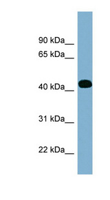 ITPK1 antibody LS-C107845 Western blot of Fetal Spleen lysate.