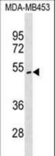 ITPK1 Antibody western blot of MDA-MB453 cell line lysates (35 ug/lane). The ITPK1 antibody detected the ITPK1 protein (arrow).